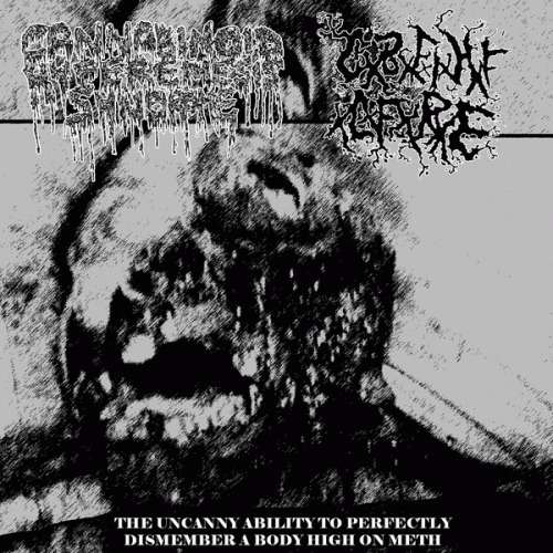 Cannabinoid Hyperemesis Syndrome : CxBxFxIxHxFxLxFxRxE - Cannabinoid Hyperemesis Syndrome